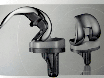 Image: The Lospa Knee System (Photo courtesy of Corentec).